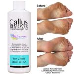 8oz Callus Remover gel for feet for a professional pedicure. Better results than, foot file, pumice stone, foot scrubber, foot buckets & callus shaver. Rid ugly callouses from feet in minutes